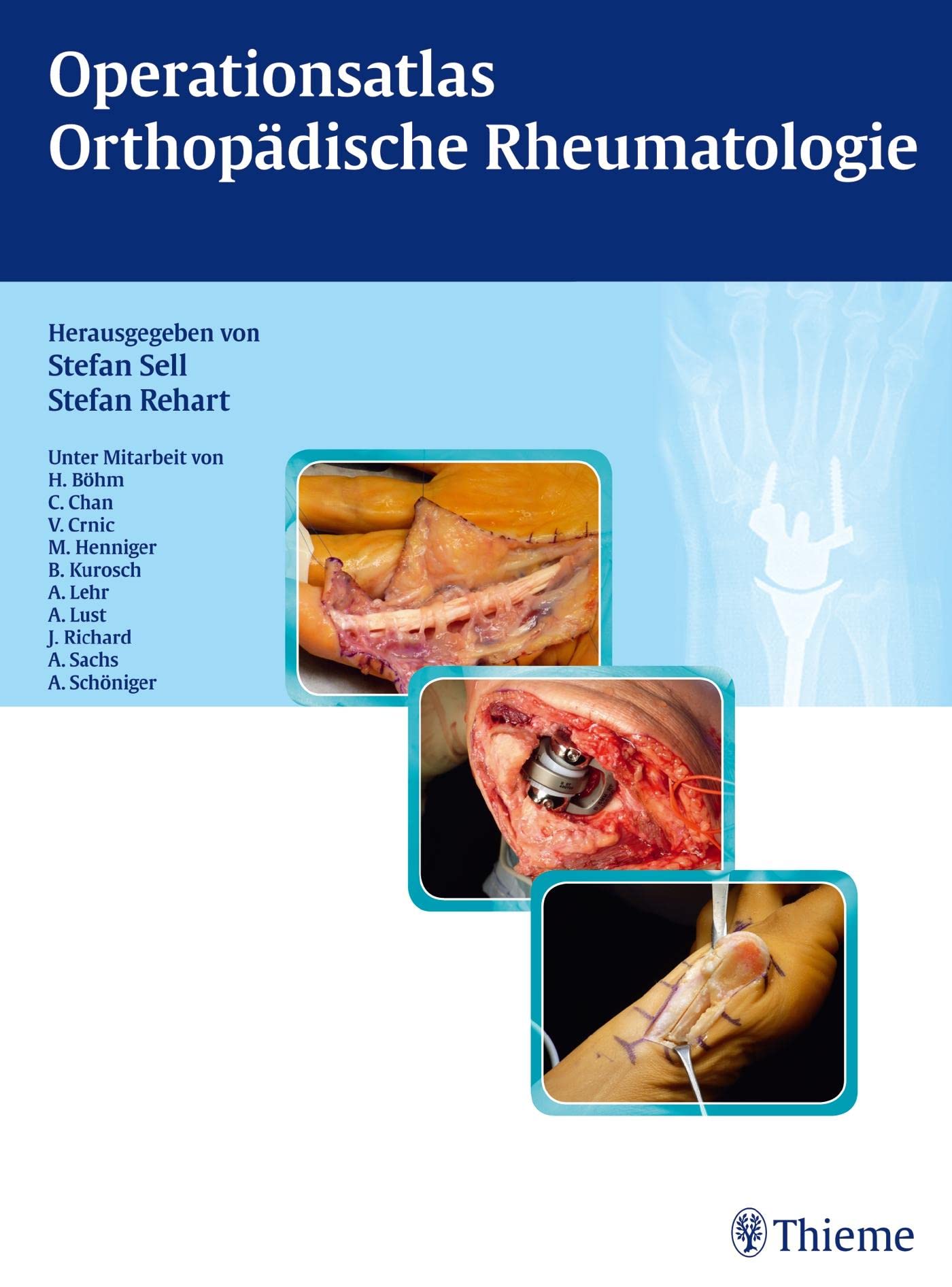 Operationsatlas Orthopädische Rheumatologie Medicine