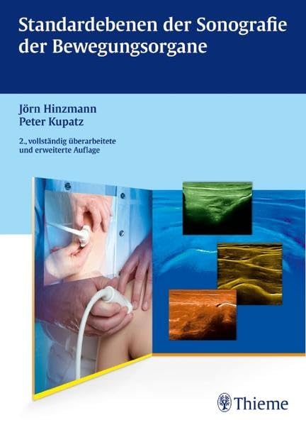 Standardebenen der Sonografie der Bewegungsorgane Medicine