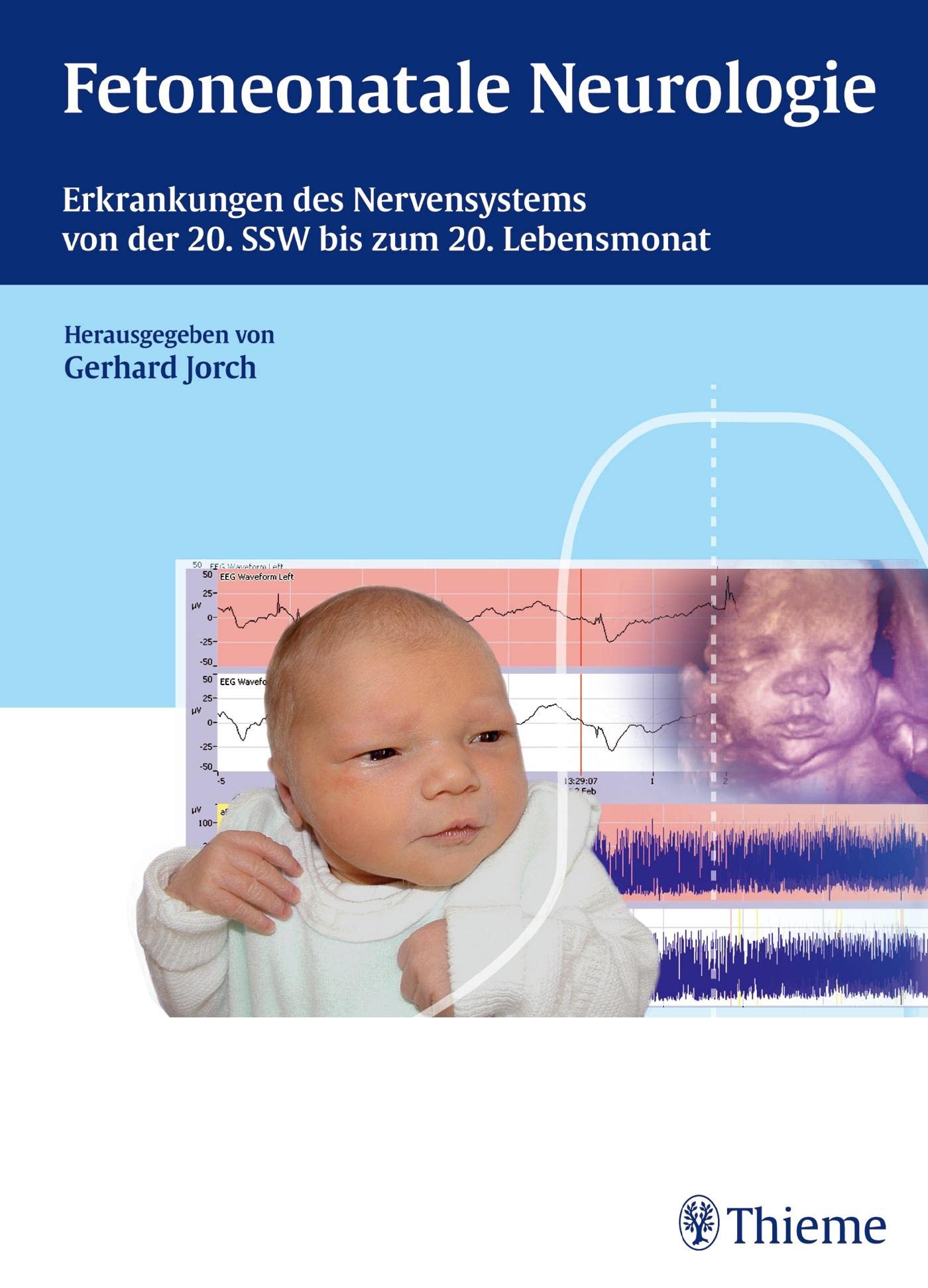 Fetoneonatale Neurologie: Erkrankungen des Nervensystems von der 20. SSW bis zum 20. Lebensmonat Medicine