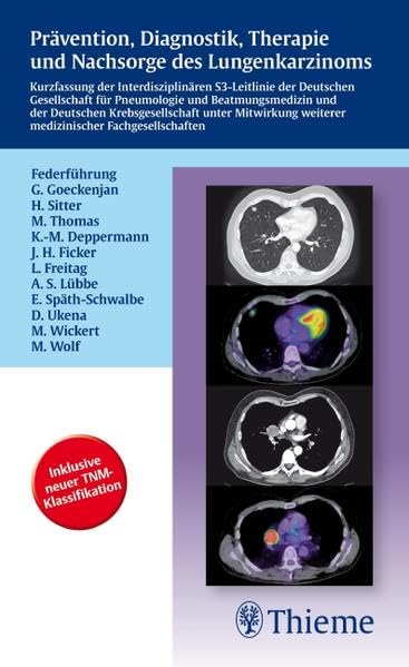 Prävention, Diagnostik, Therapie und Nachsorge des Lungenkarzinoms: Kurzfassung der Interdisziplinären S3-Leitlinie der Dt. Gesellschaft f. Pneumolo Medicine