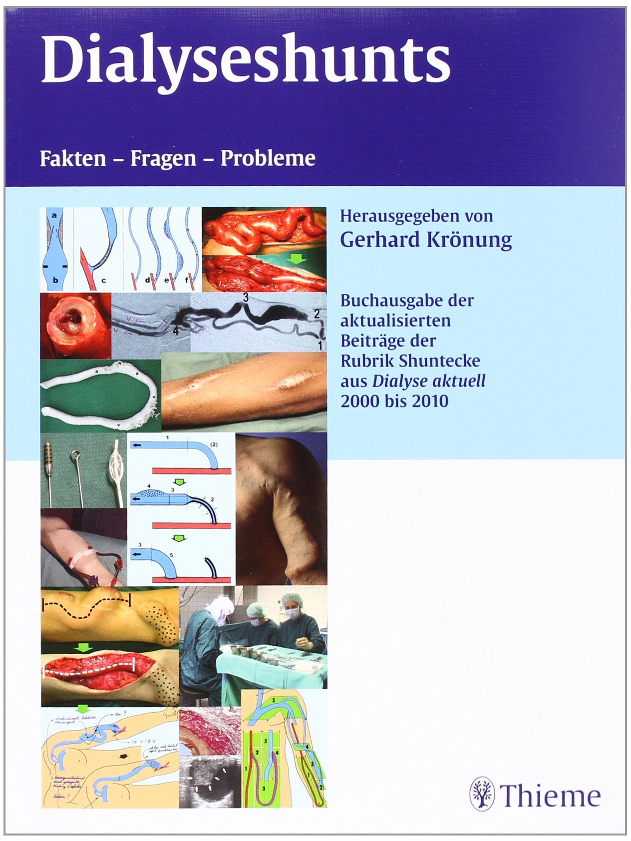 Dialyseshunts: Fragen, Fakten, Probleme - Buchsonderausgabe Sonderdrucke aus Dialyse Aktuell Medicine
