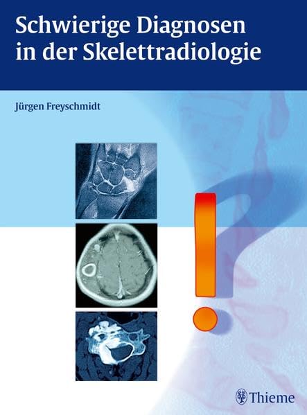 Schwierige Diagnosen in der Skelettradiologie Medicine