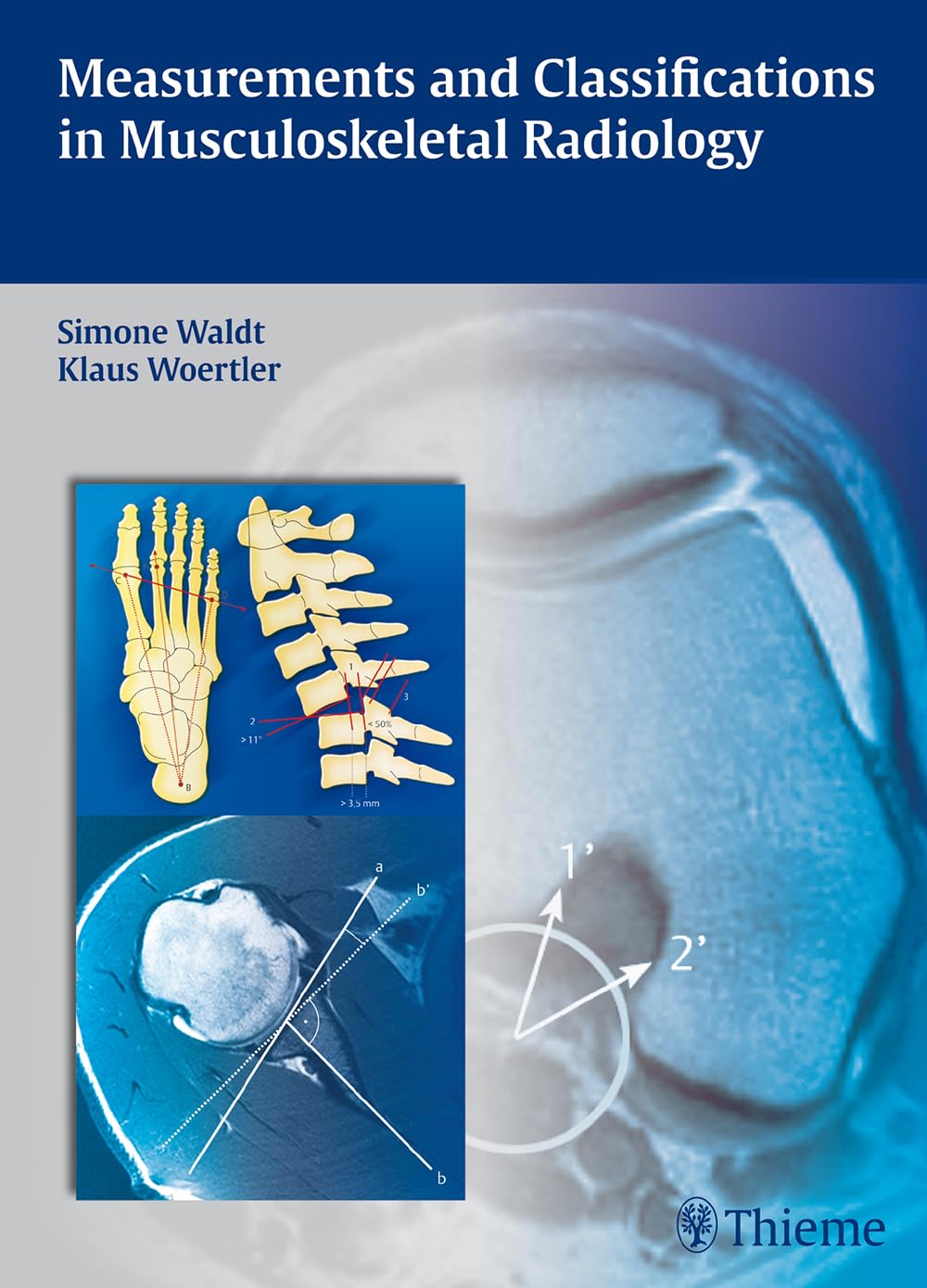 Measurements and Classifications in Musculoskeletal Radiology Medicine