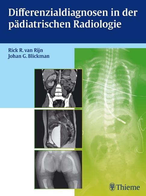 Differenzialdiagnosen in der pädiatrischen Radiologie Medicine