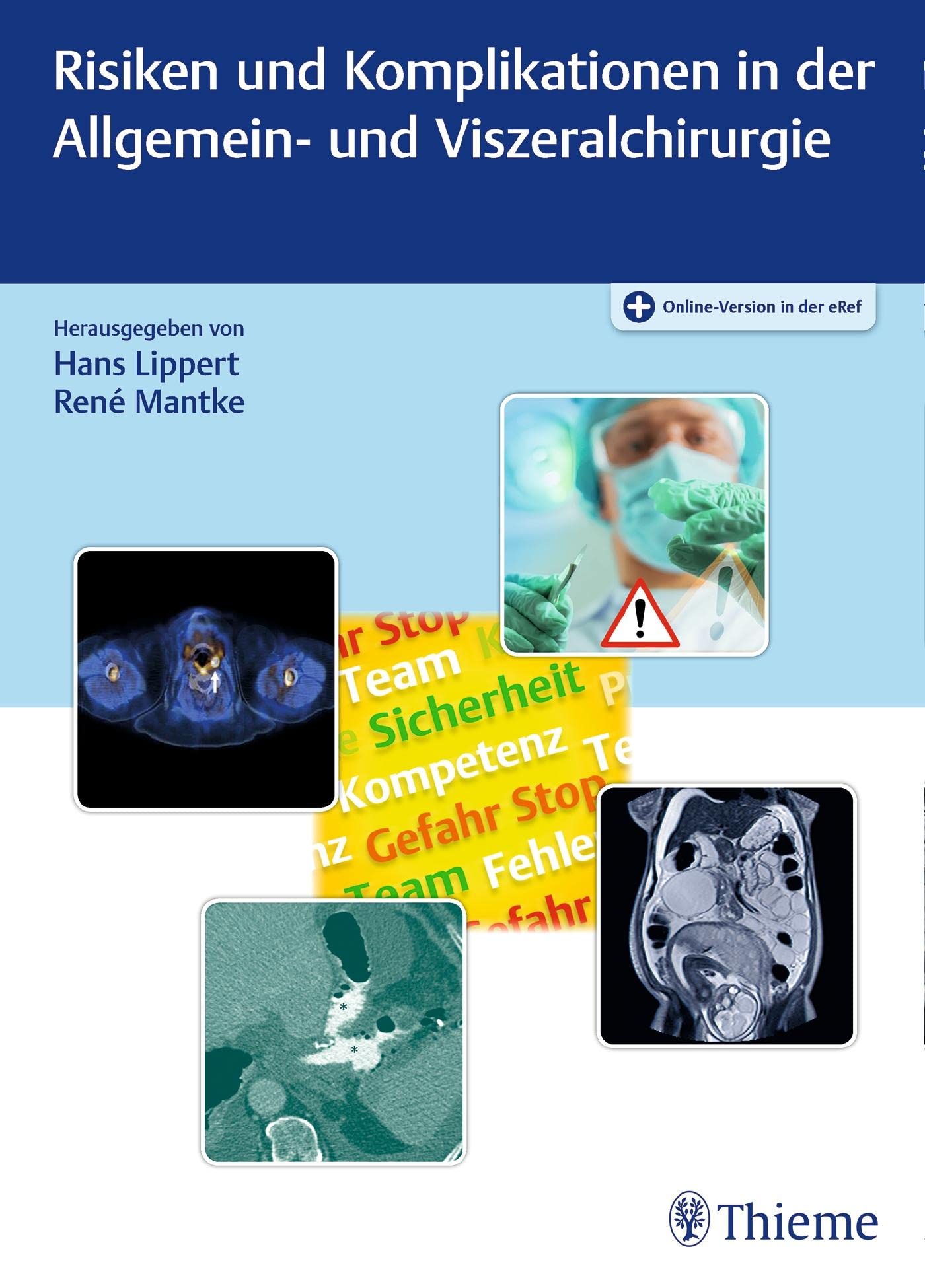 Risiken und Komplikationen in der Allgemein- und Viszeralchirurgie Medicine