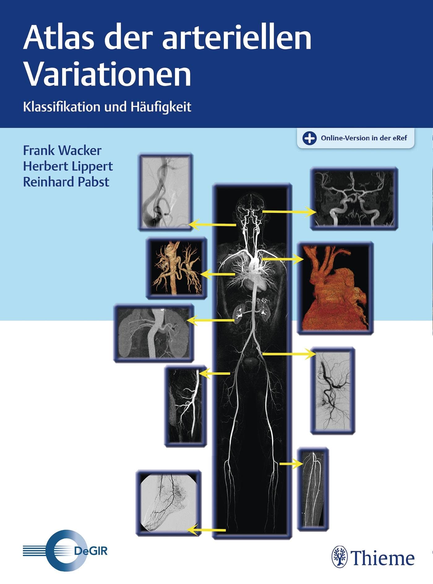 Atlas der arteriellen Variationen: Klassifikation und Häufigkeit Medicine