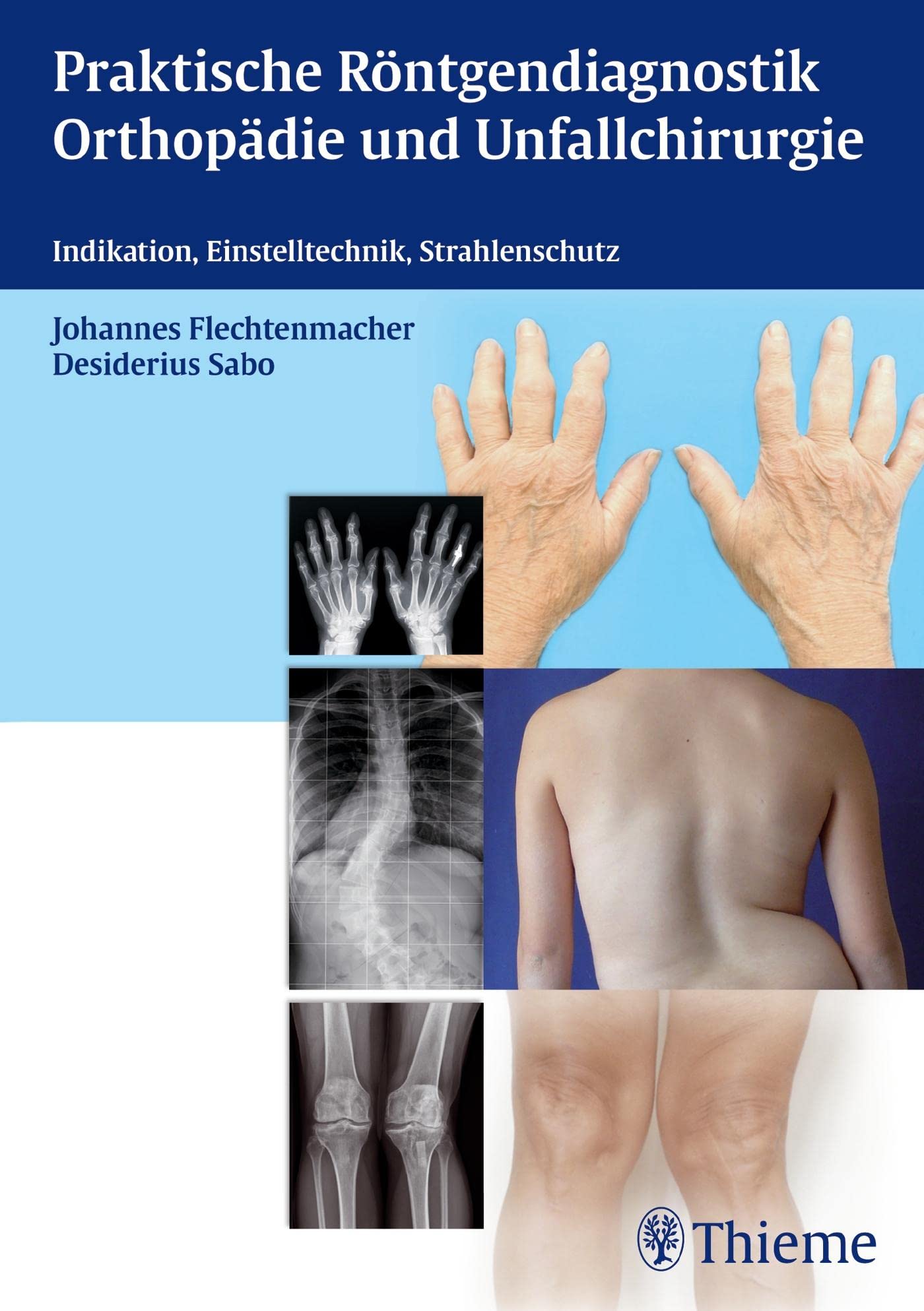 Praktische Röntgendiagnostik Orthopädie und Unfallchirurgie: Indikation, Einstelltechnik, Strahlenschutz Medicine