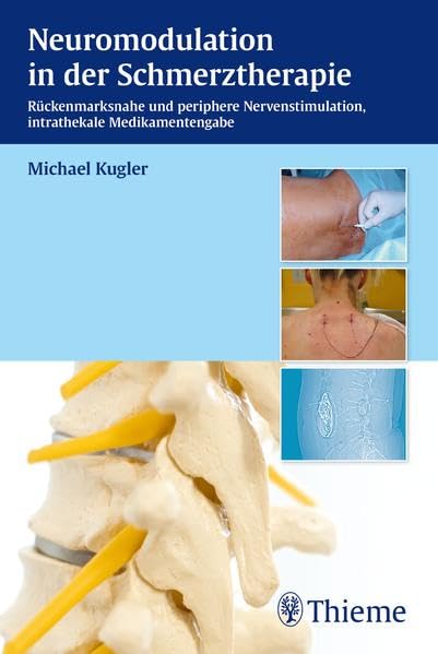 Neuromodulation in der Schmerztherapie: Epidurale und subkutane Nervenstimulation - Intrathekale Medikamentengabe book