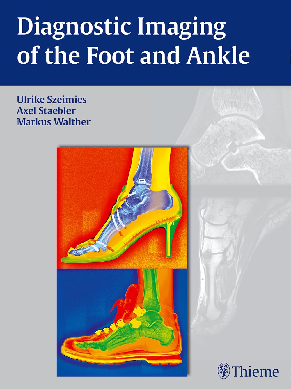 Diagnostic Imaging of the Foot and Ankle Medicine