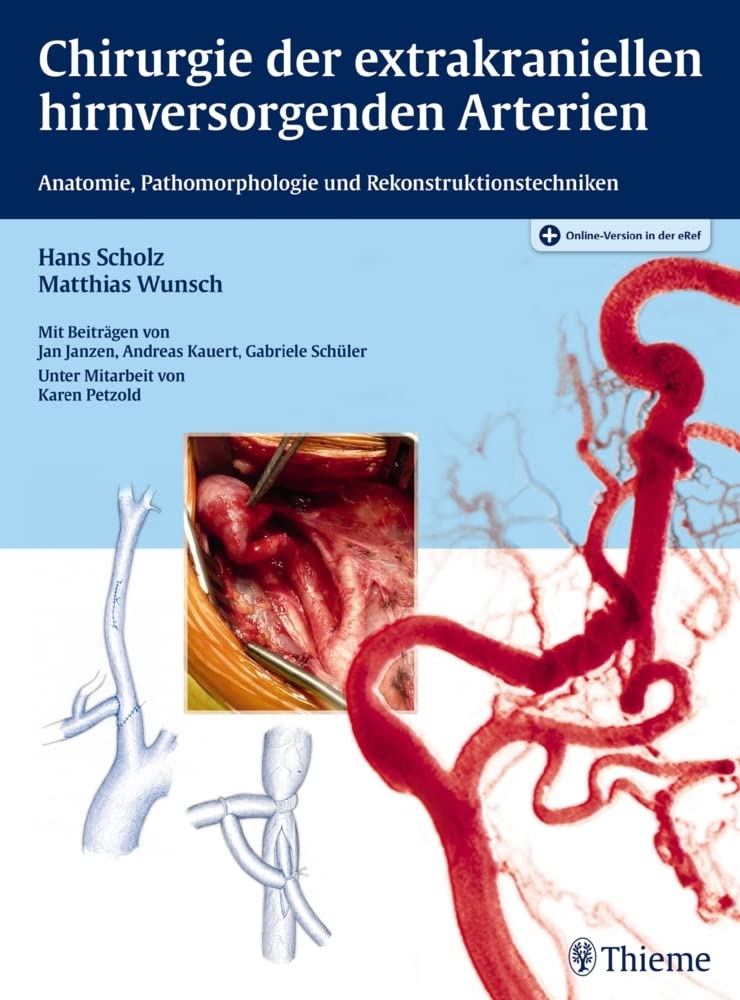 Chirurgie der extrakraniellen hirnversorgenden Arterien Medicine