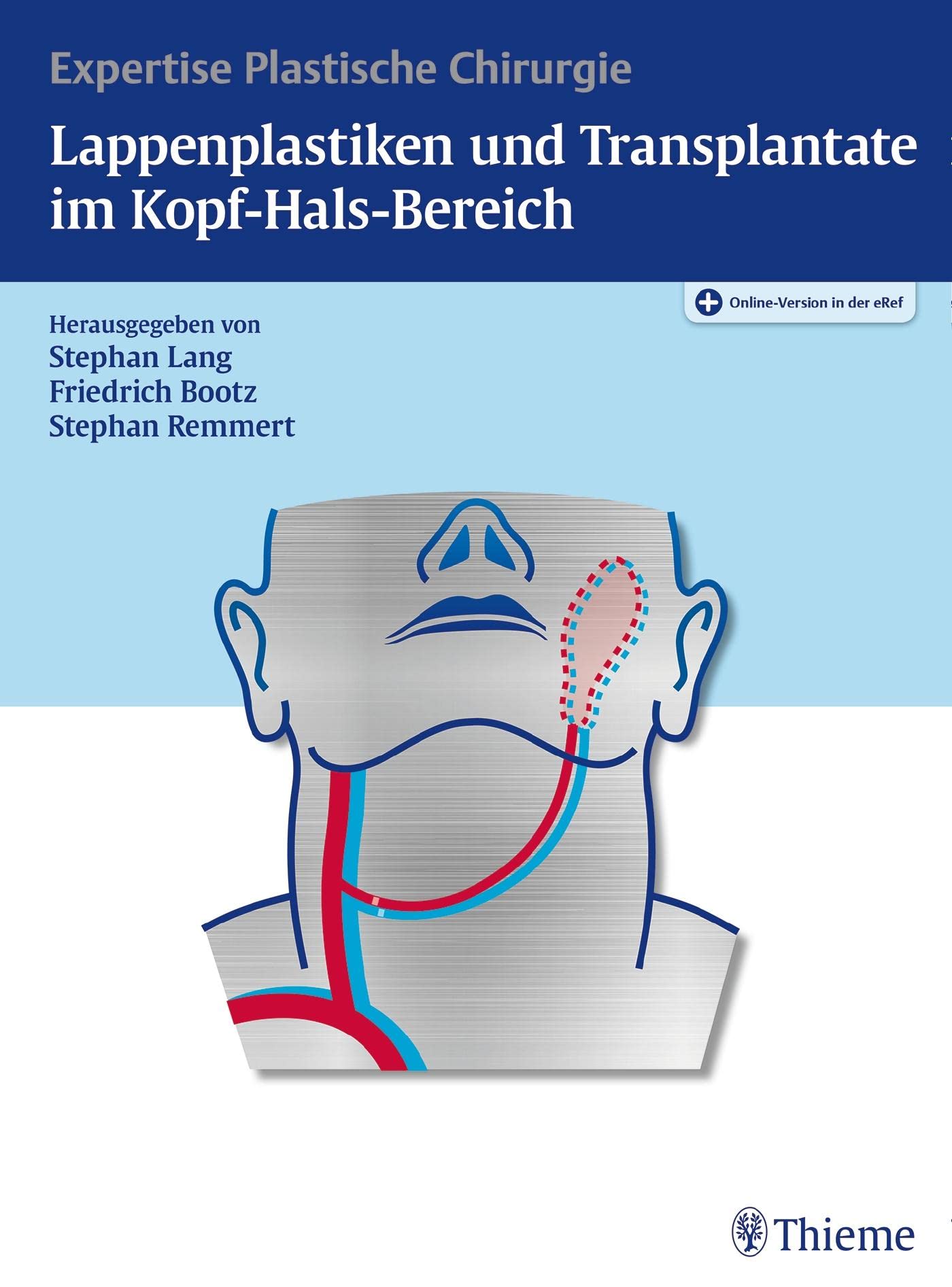Lappenplastiken und Transplantate im Kopf-Hals-Bereich: Expertise Plastische Chirurgie book