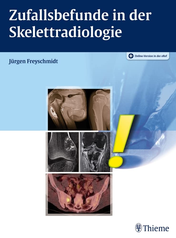 Zufallsbefunde in der Skelettradiologie Medicine