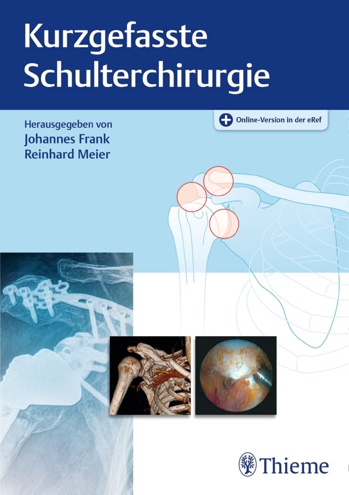 Kurzgefasste Schulterchirurgie Medicine