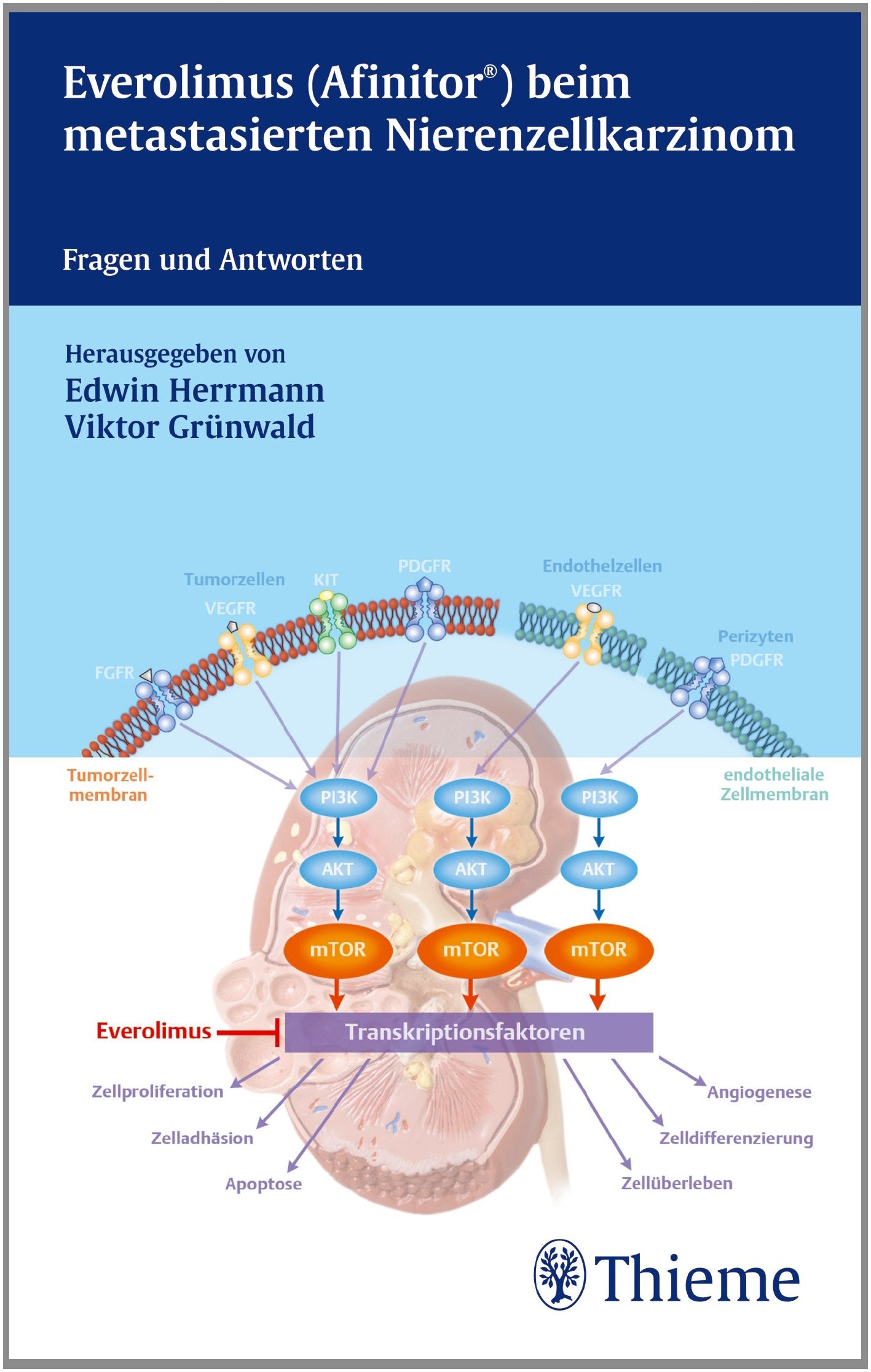 Everolismus (Affinitor) beim metastatsierenden Nierenzellkarzinom Medicine