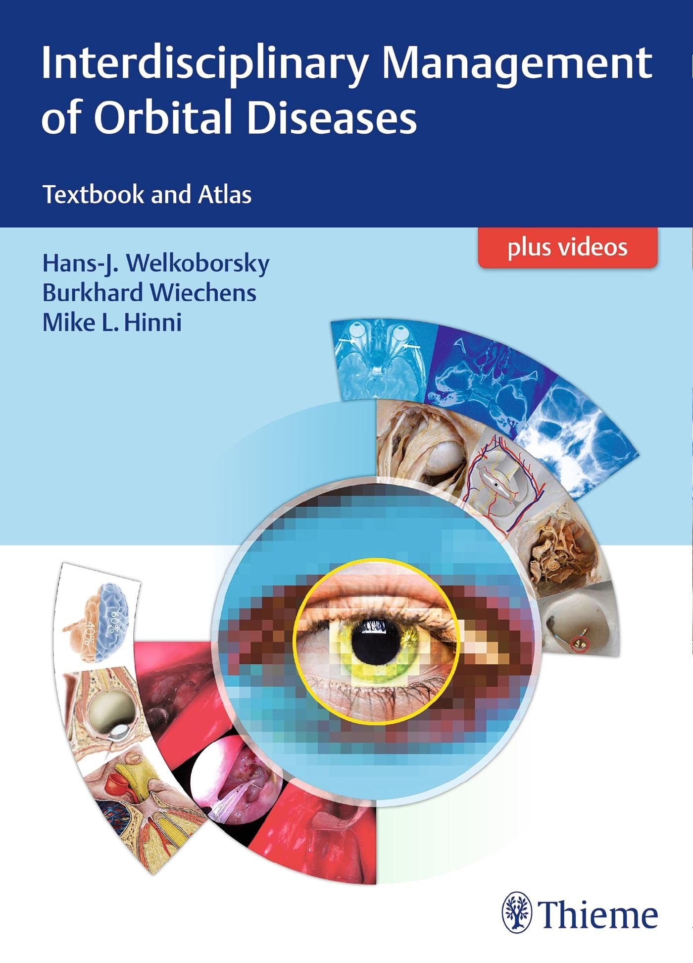 Interdisciplinary Management of Orbital Diseases: Textbook and Atlas Medicine