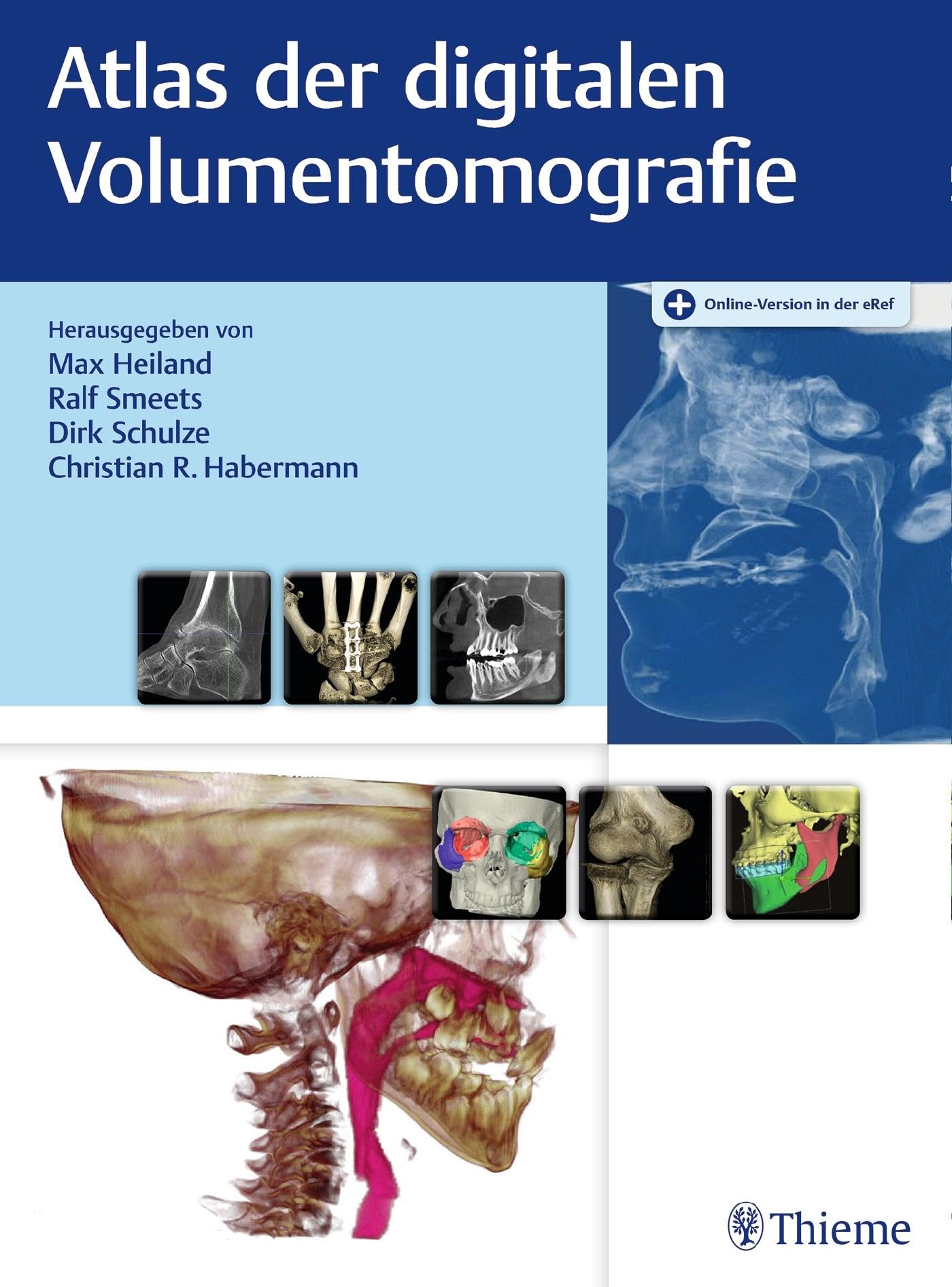 Atlas der digitalen Volumentomografie Medicine