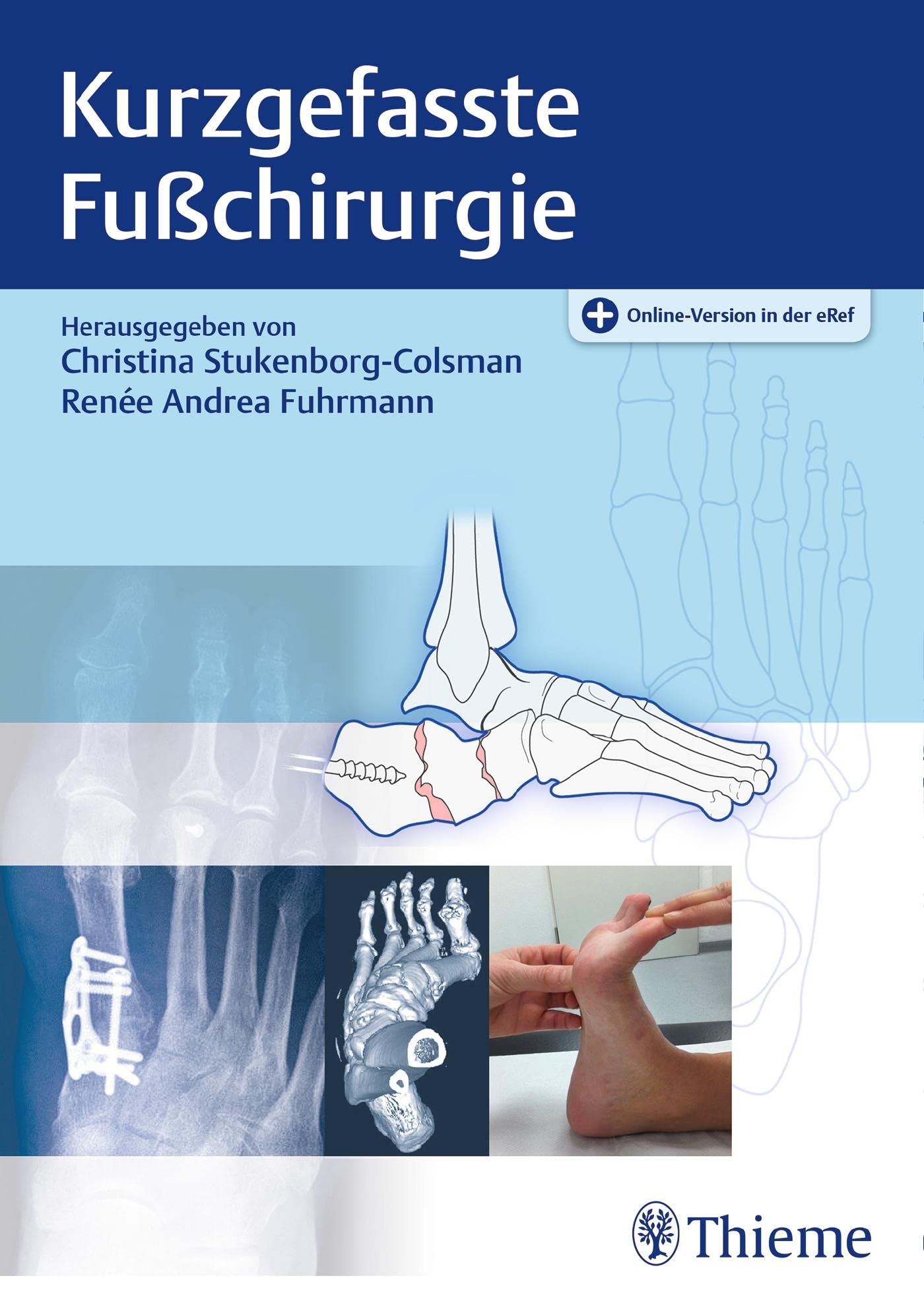 Kurzgefasste Fußchirurgie: Mit Online-Version in der eRef Medicine