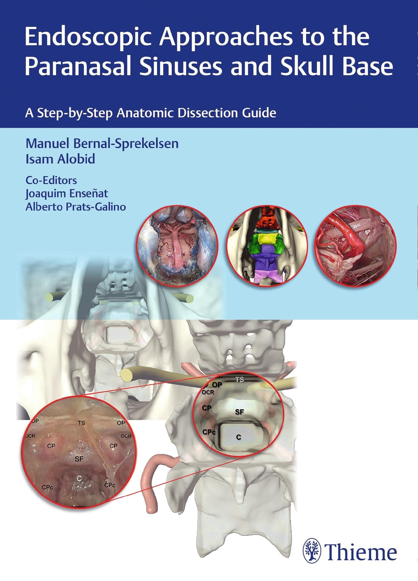 Endoscopic Approaches to the Paranasal Sinuses and Skull Base: A Step-by-Step Anatomic Dissection Guide Medicine