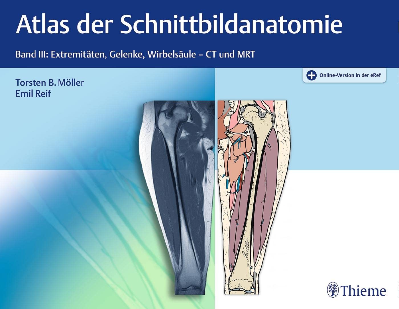 Product Image: Atlas der Schnittbildanatomie. Band 03