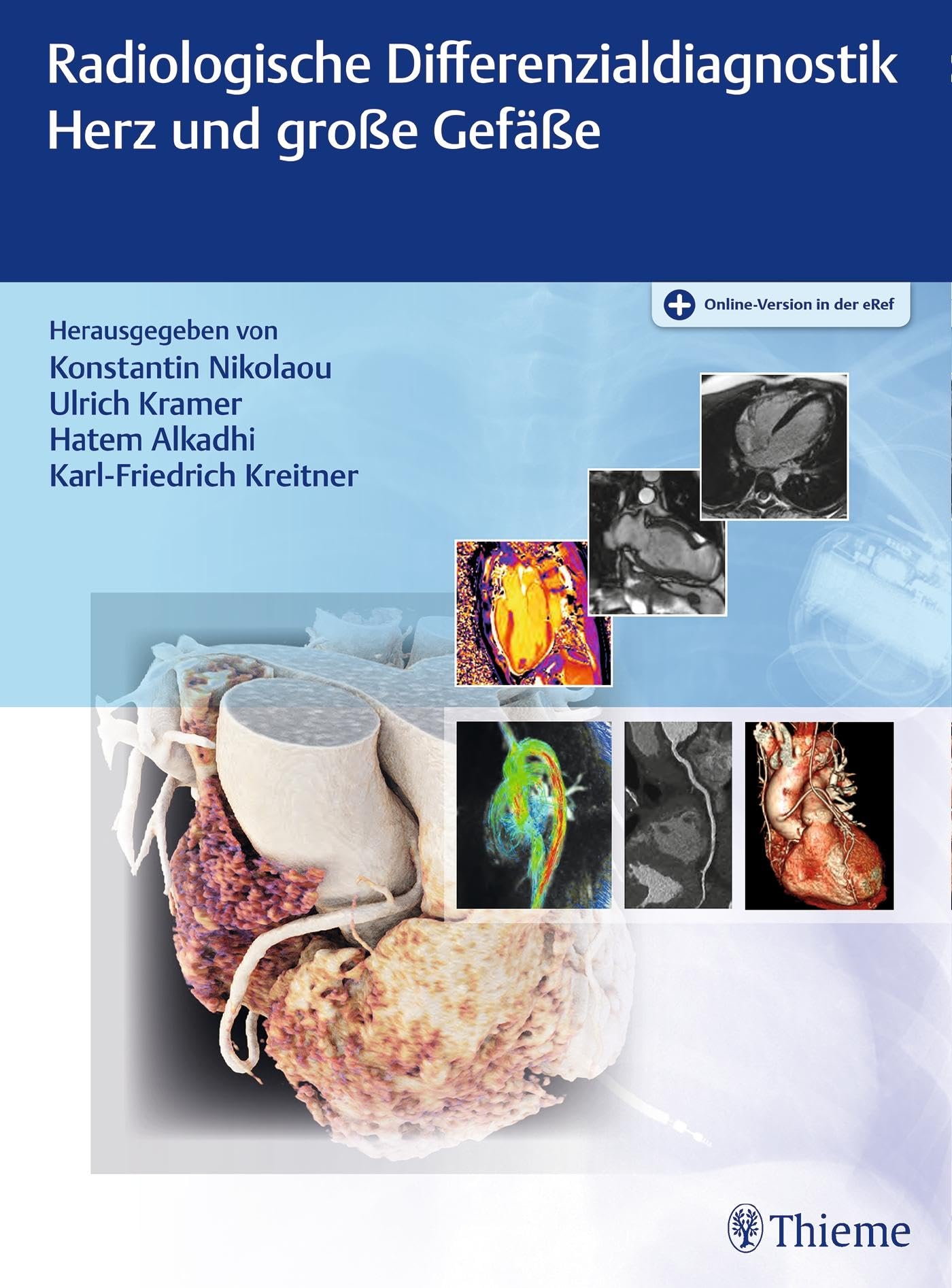 Radiologische Differenzialdiagnostik Herz und große Gefäße Medicine