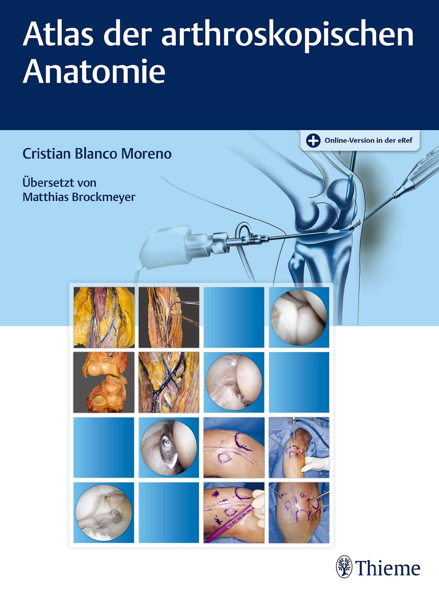 Atlas der arthroskopischen Anatomie Medicine