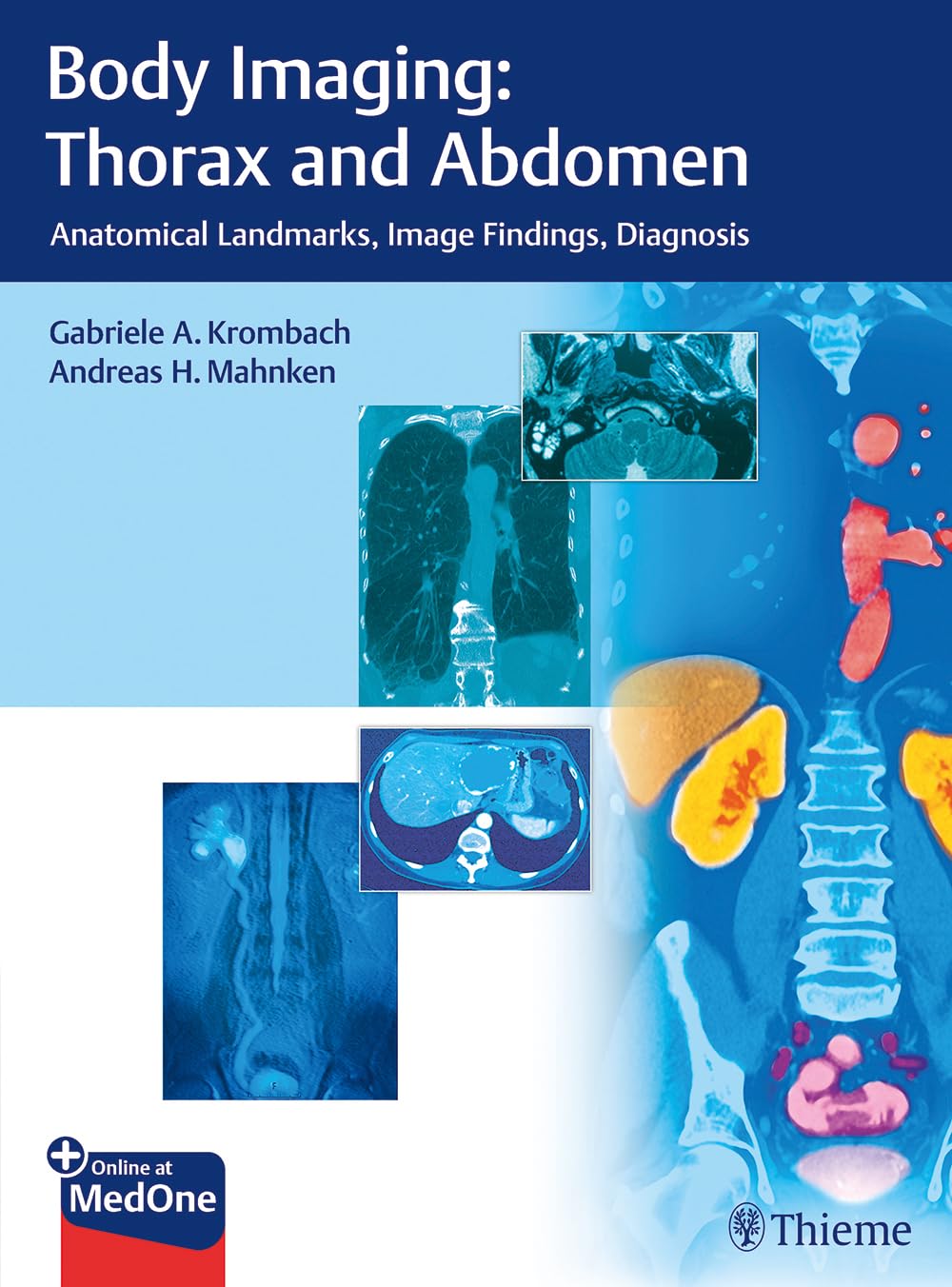 Body Imaging: Thorax and Abdomen: Anatomical Landmarks, Image Findings, Diagnosis Medicine