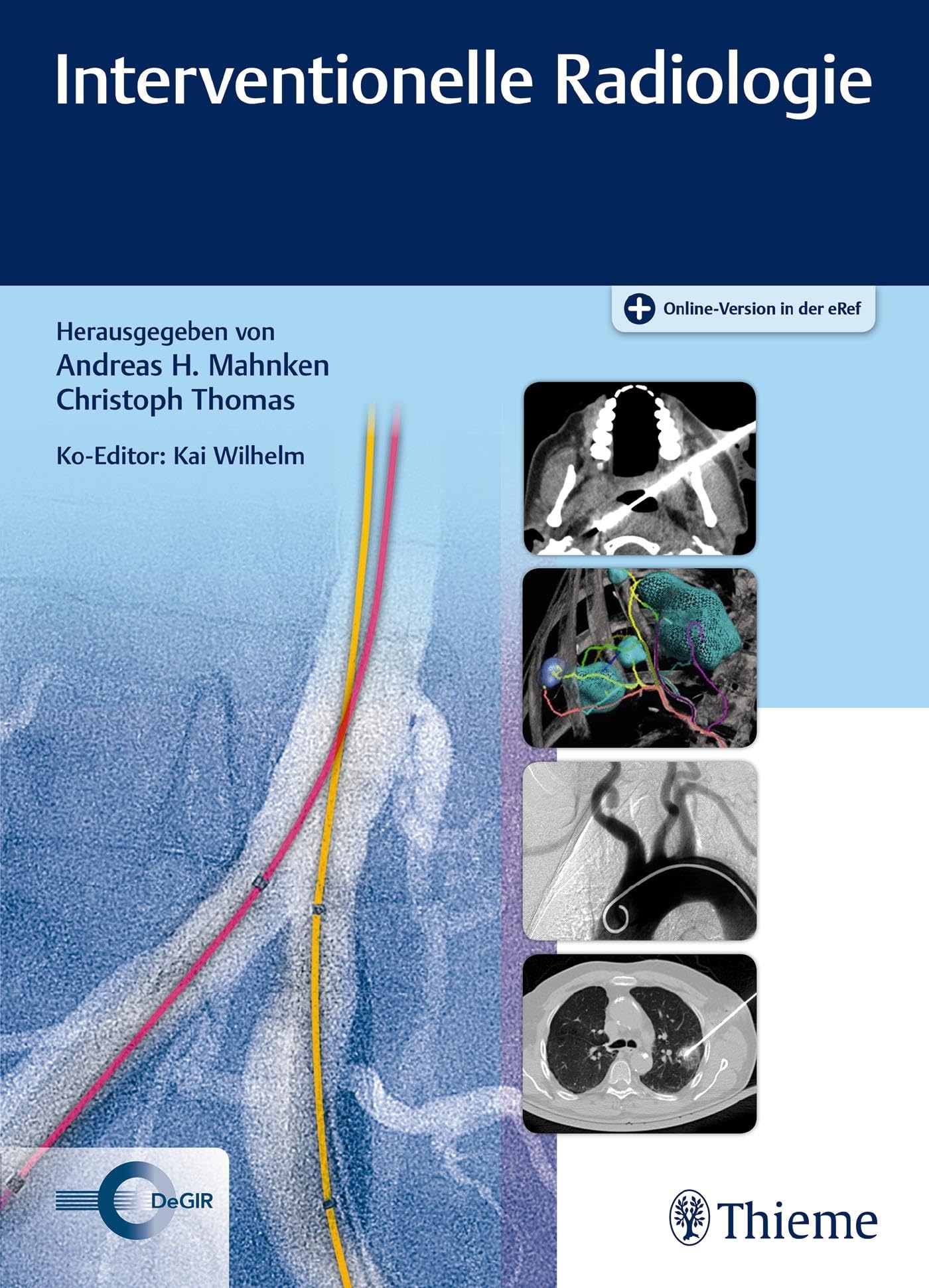 Interventionelle Radiologie Medicine Books