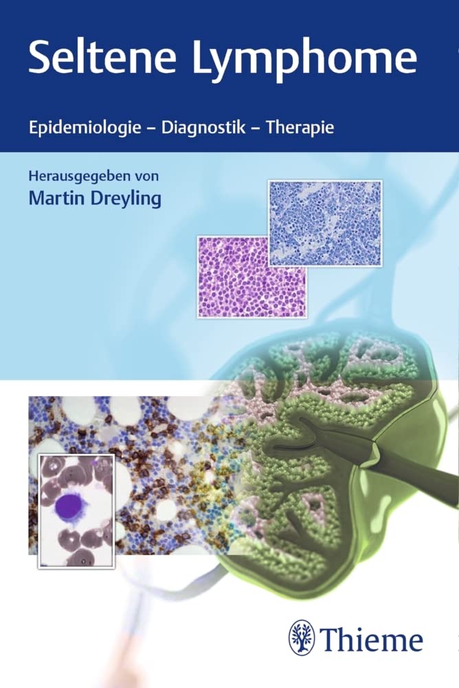 Seltene Lymphome Medicine