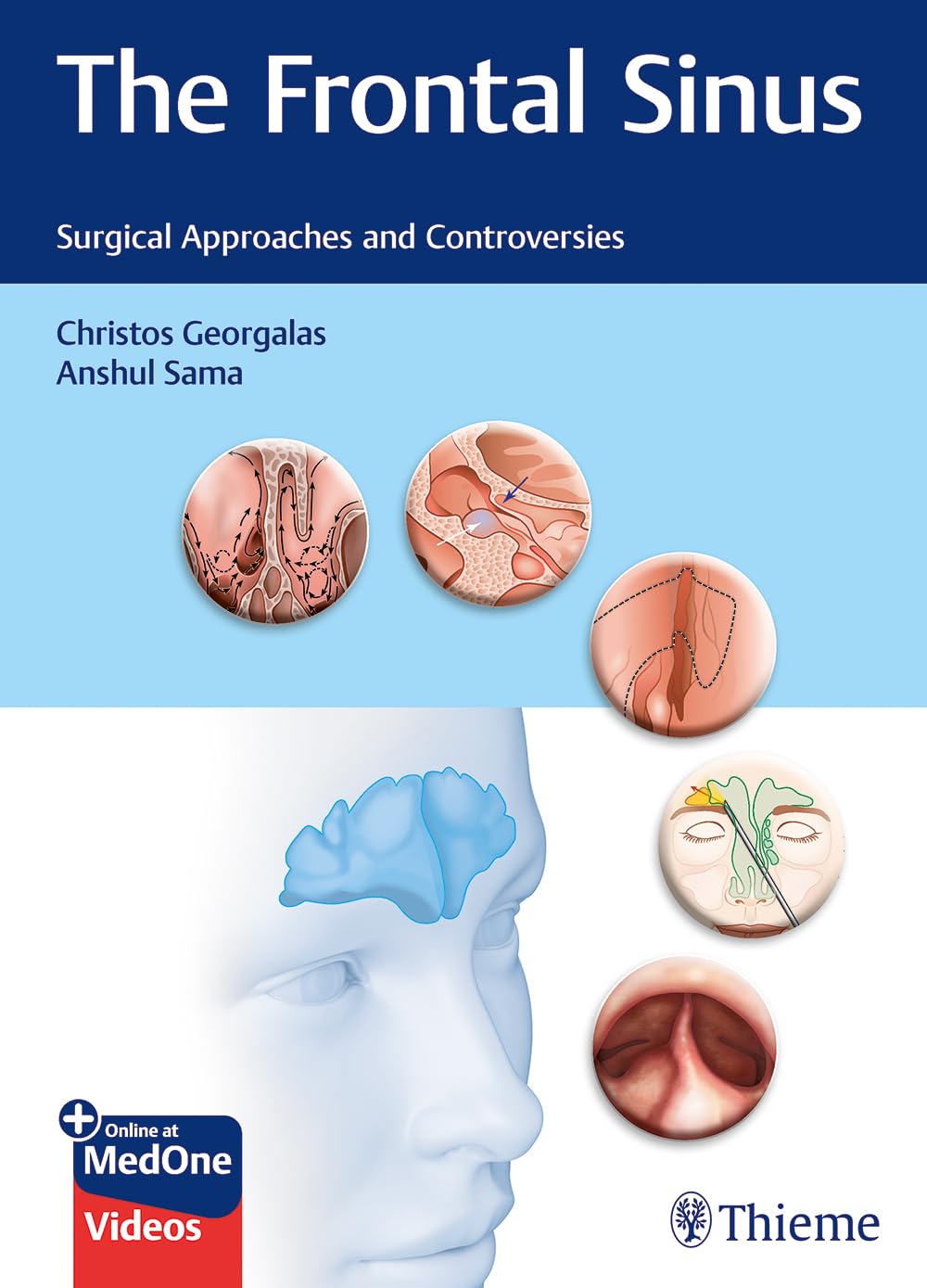 Product Image: The Frontal Sinus