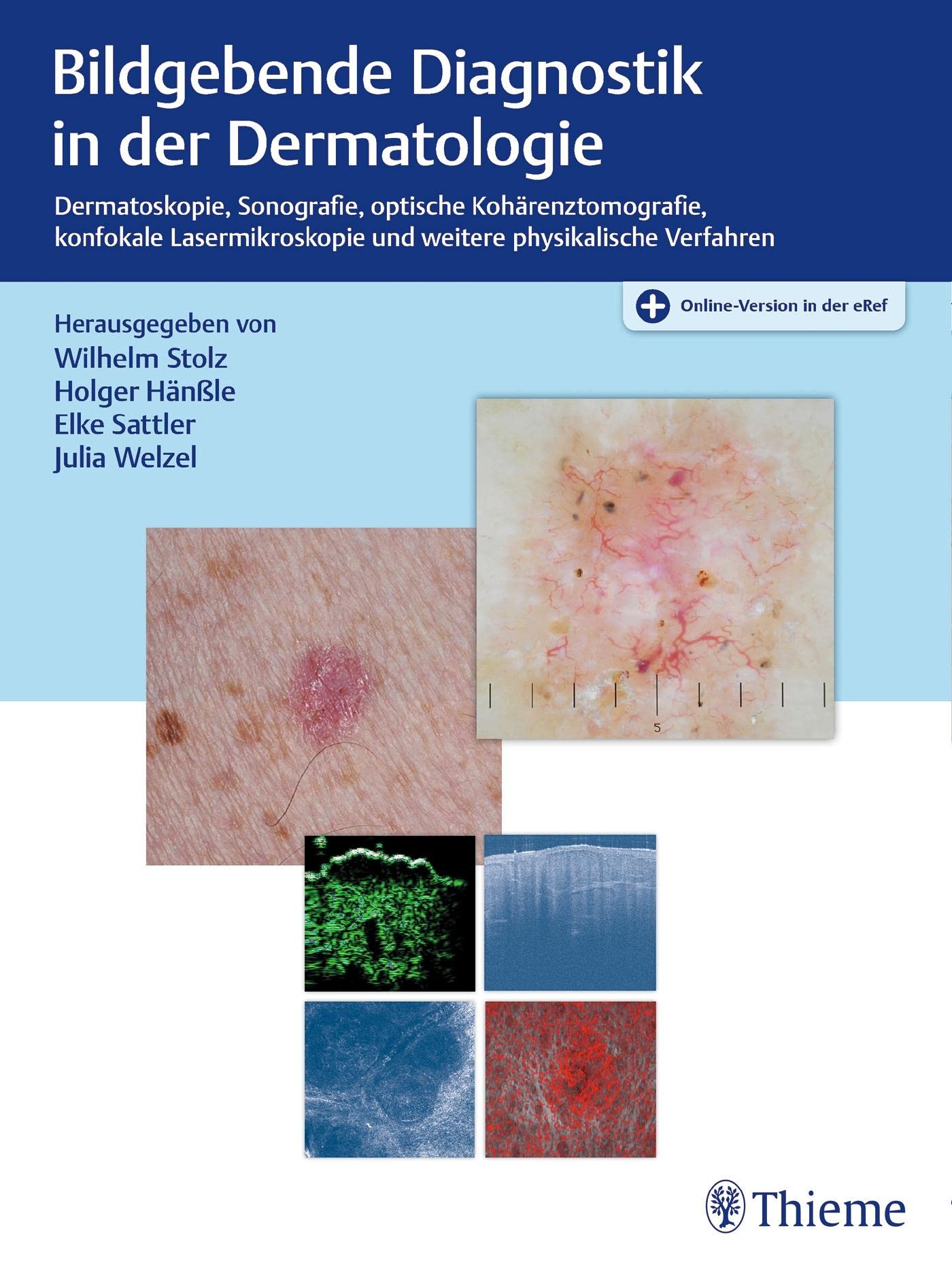 Bildgebende Diagnostik in der Dermatologie: Dermatoskopie, Konfokale Laserscanmikroskopie, Optische Kohärenztomografie, Sonografie Medicine