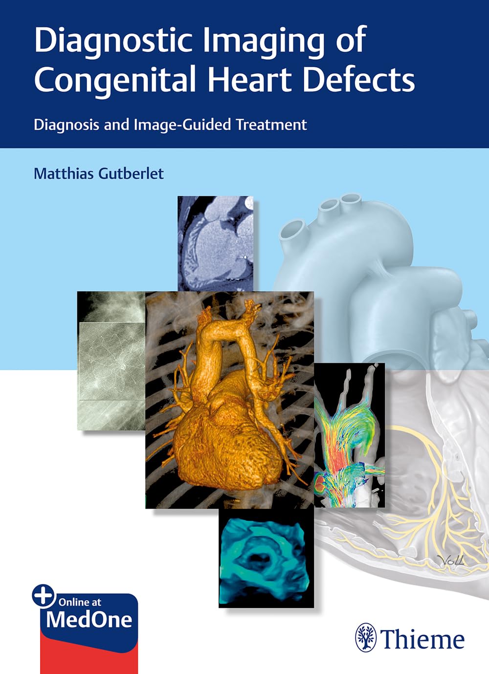 Diagnostic Imaging of Congenital Heart Defects: Diagnosis and Image-Guided Treatment Medicine