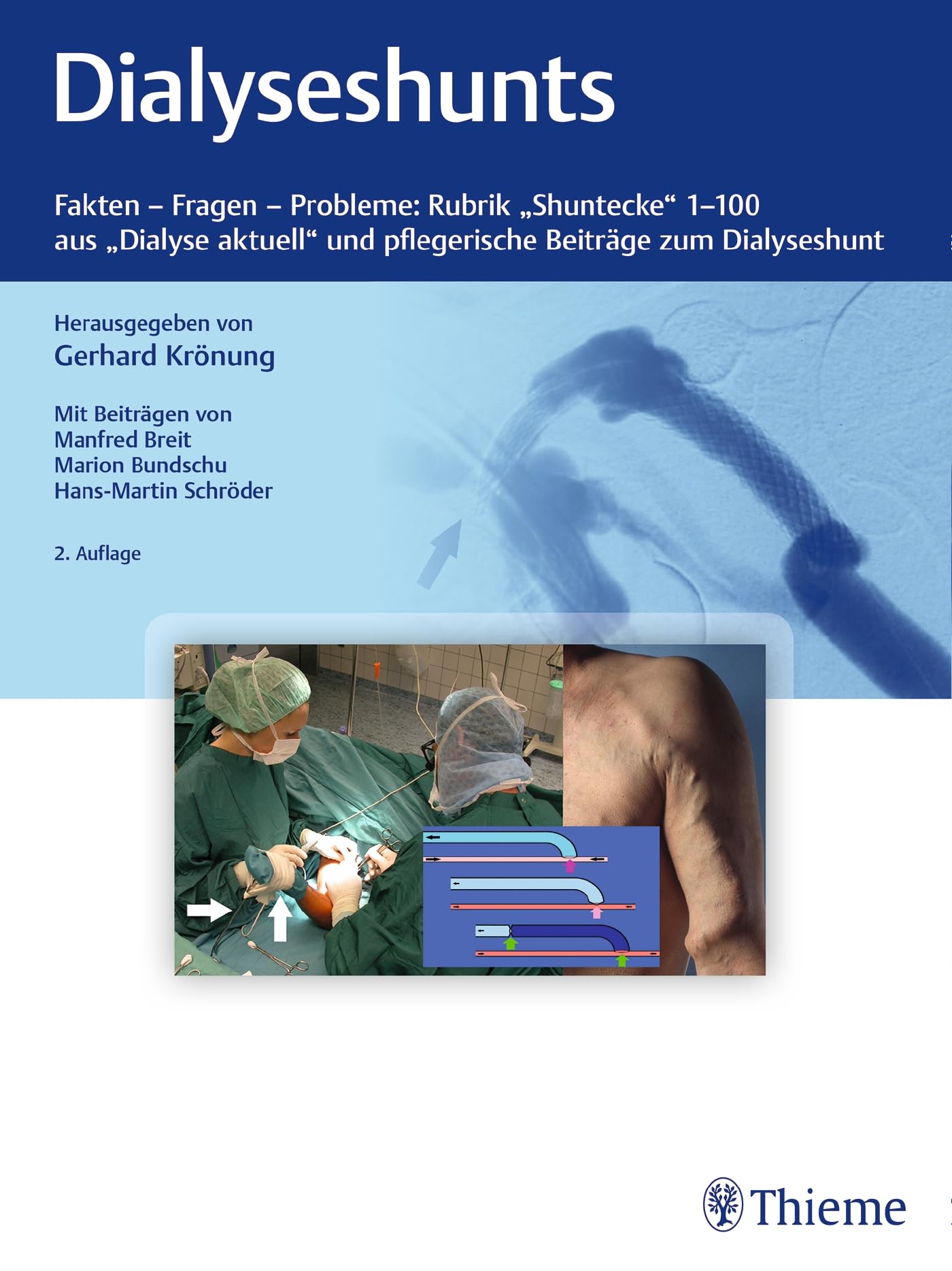 Dialyseshunts: Fragen - Fakten - Probleme: Rubrik: "Shuntecke" 1-100 aus "Dialyse aktuell" und pflegerische Beiträge zum Dialyseshunt book