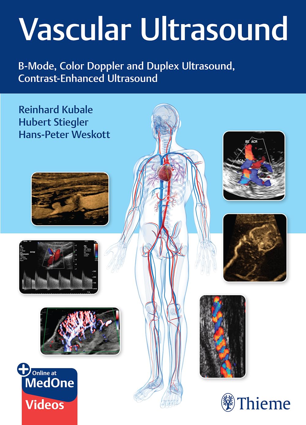 Vascular Ultrasound: B-Mode, Color Doppler and Duplex Ultrasound, Contrast-Enhanced Ultrasound Medicine