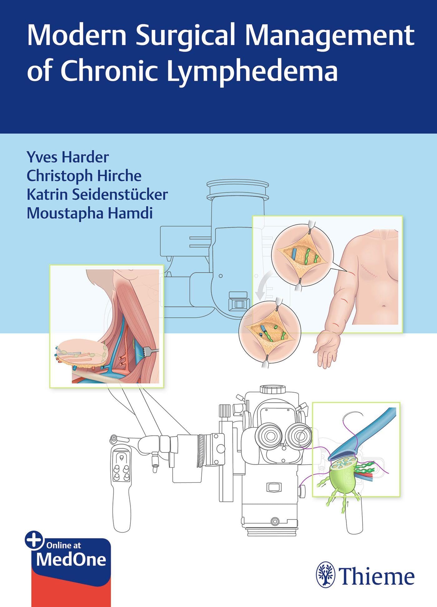 Modern Surgical Management of Chronic Lymphedema Medicine