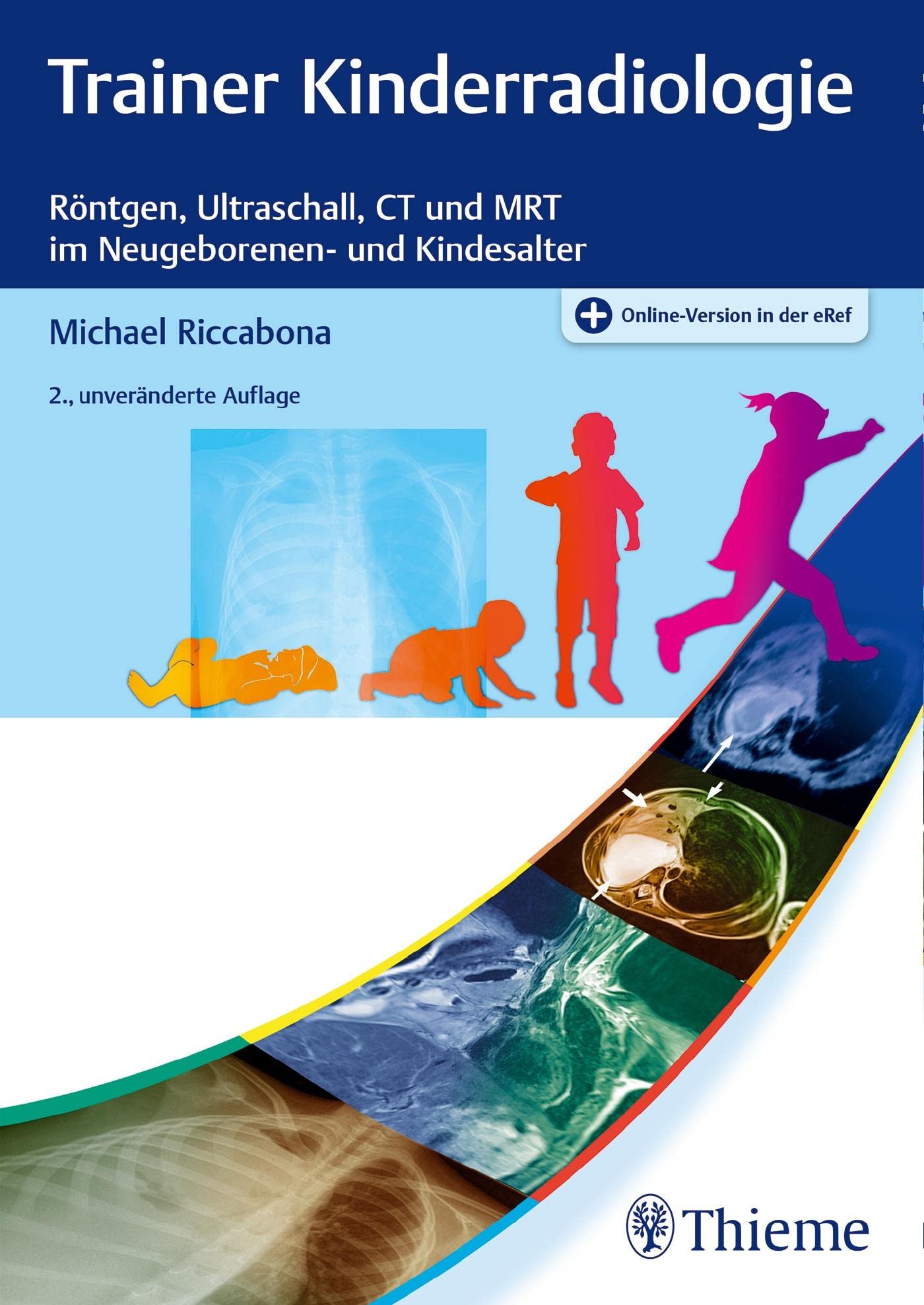 Trainer Kinderradiologie: Röntgen, Ultraschall, CT und MRT im Neugeborenen- und Kindesalter Medicine