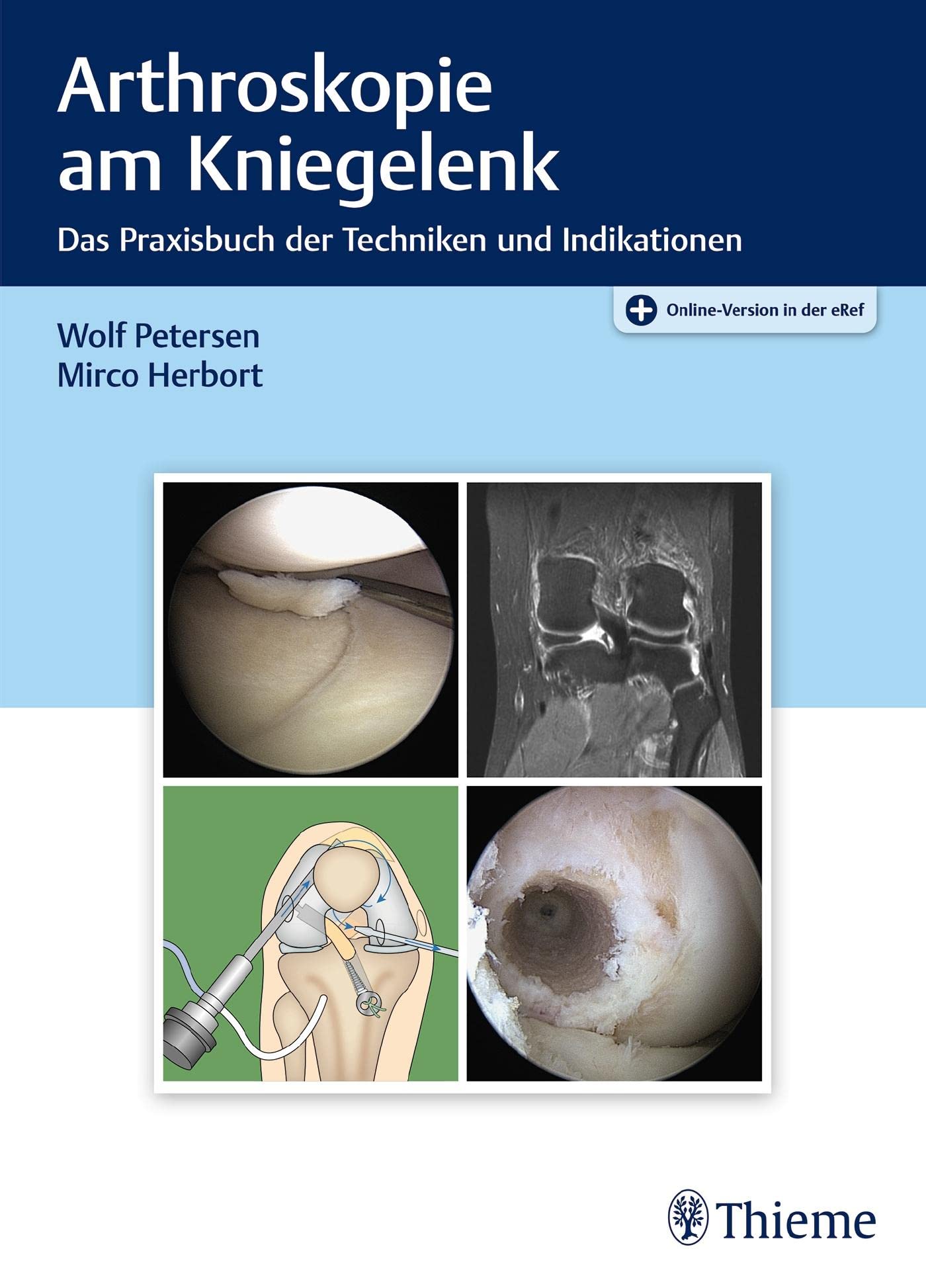 Arthroskopie am Kniegelenk Medicine