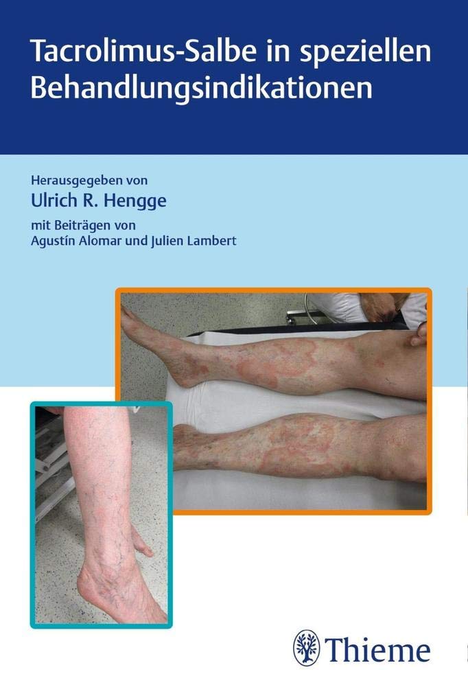 Tacrolimus-Salbe in speziellen Behandlungsindikationen Medicine