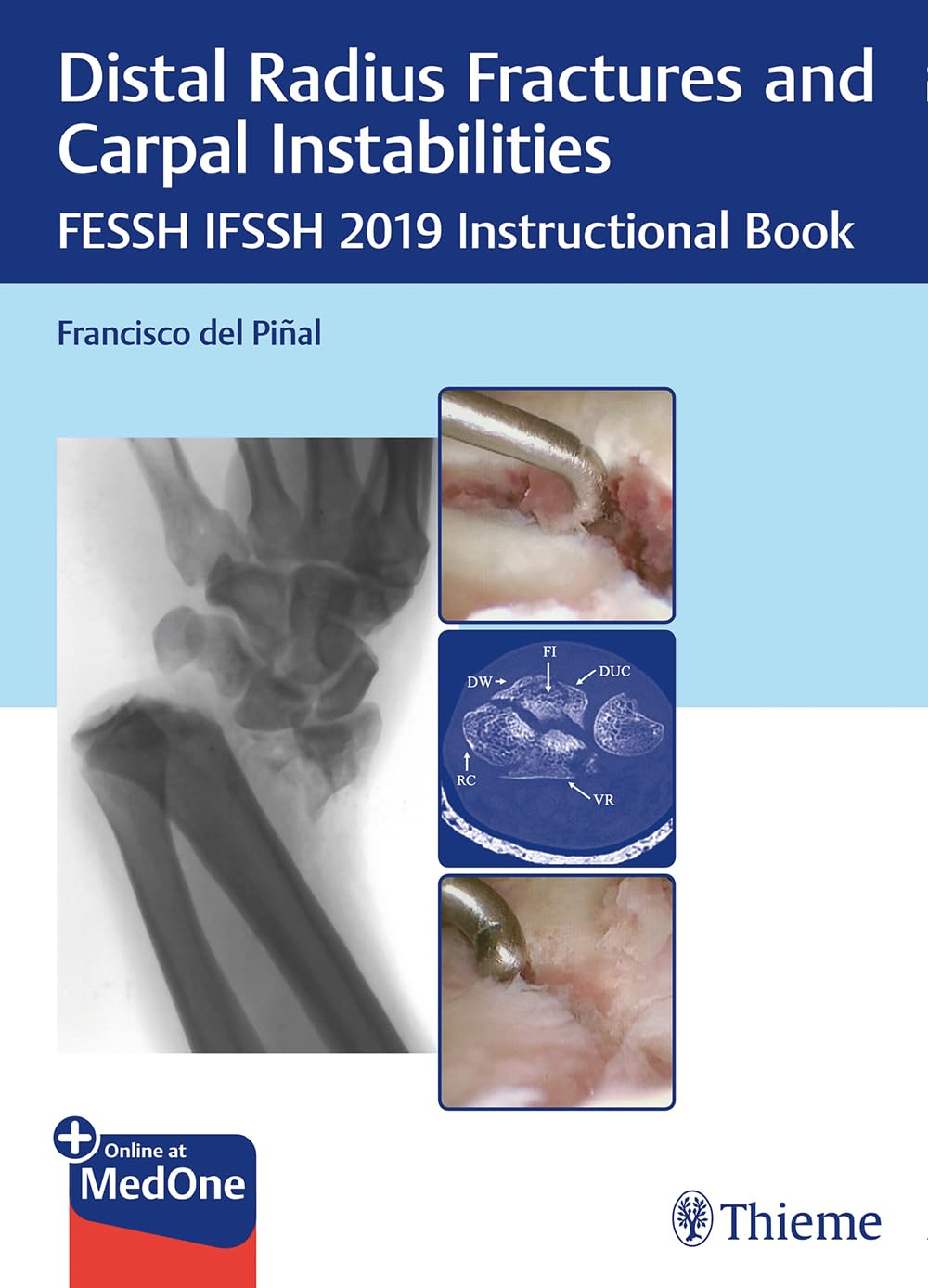Product Image: Distal Radius Fractures and Carpal Instabilities