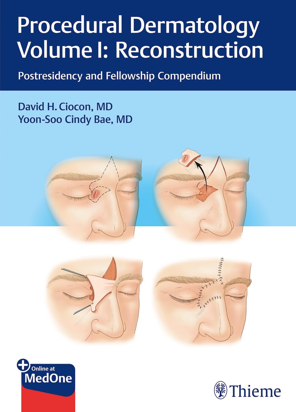 Procedural Dermatology Volume I: Reconstruction: Postresidency and Fellowship Compendium (Procedural Dermatology, 1, Band 1) Medicine