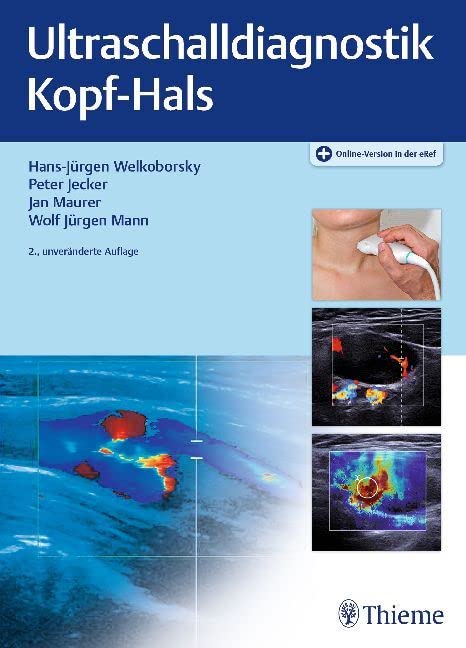 Ultraschalldiagnostik Kopf-Hals book
