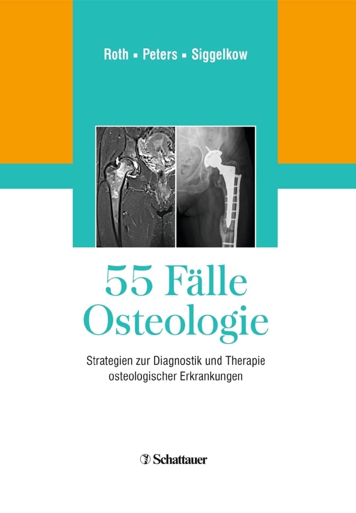 Product Image: 55 Fälle Osteologie