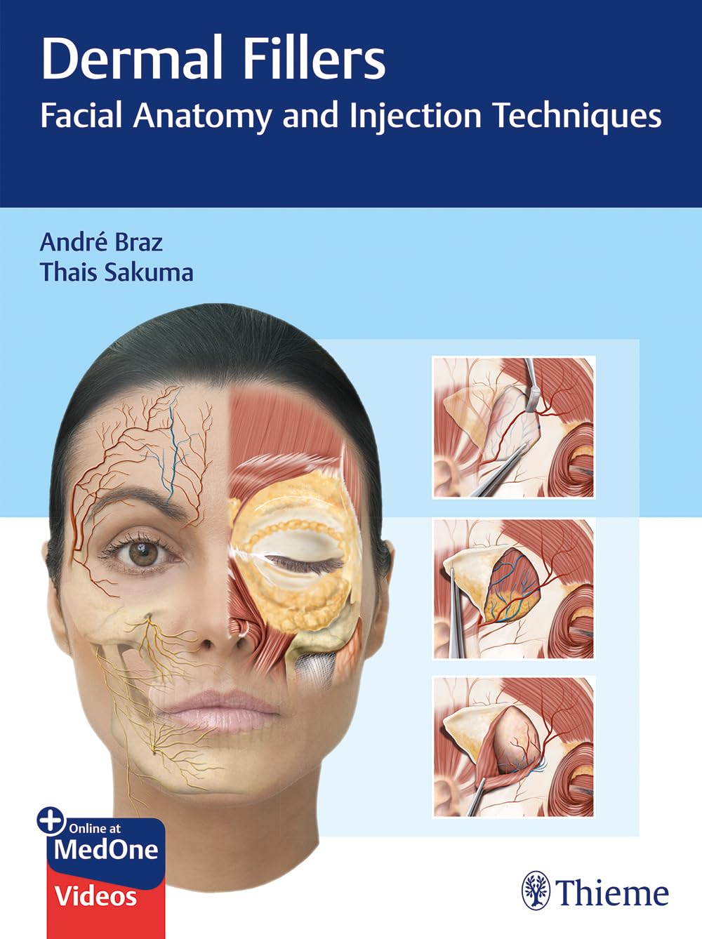 Dermal Fillers: Facial Anatomy and Injection Techniques Medicine