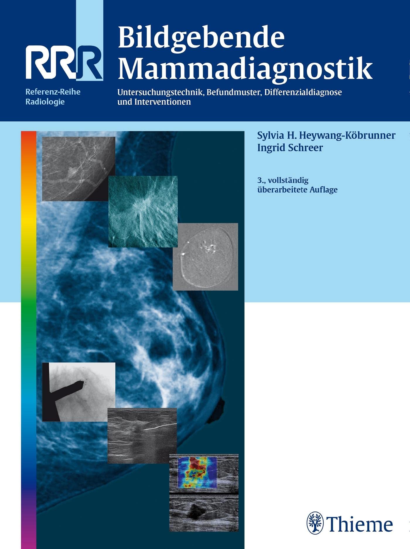 Bildgebende Mammadiagnostik: Untersuchungstechnik, Befundmuster, Differenzialdiagnose und Interventionen Medicine