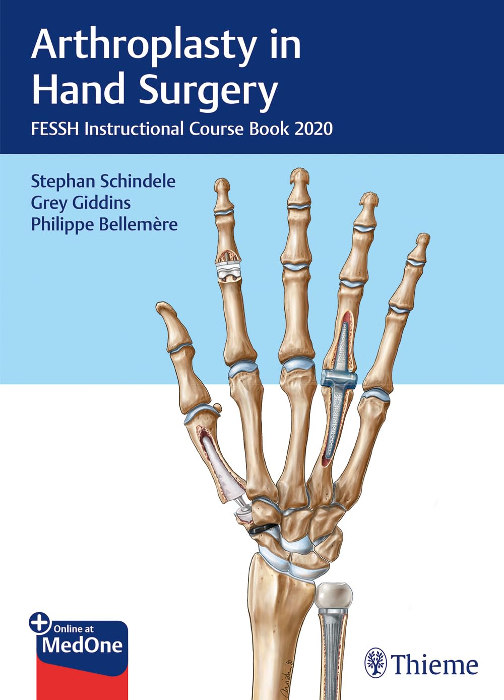 Arthroplasty in Hand Surgery: FESSH Instructional Course Book 2020 book
