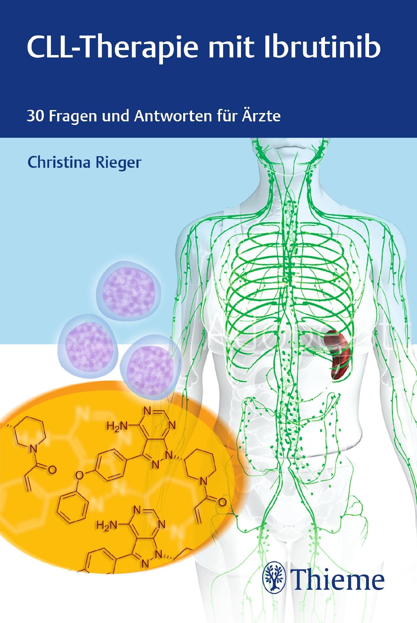 CLL-Therapie mit Ibrutinib: 30 Fragen und Antworten für Ärzte Medicine