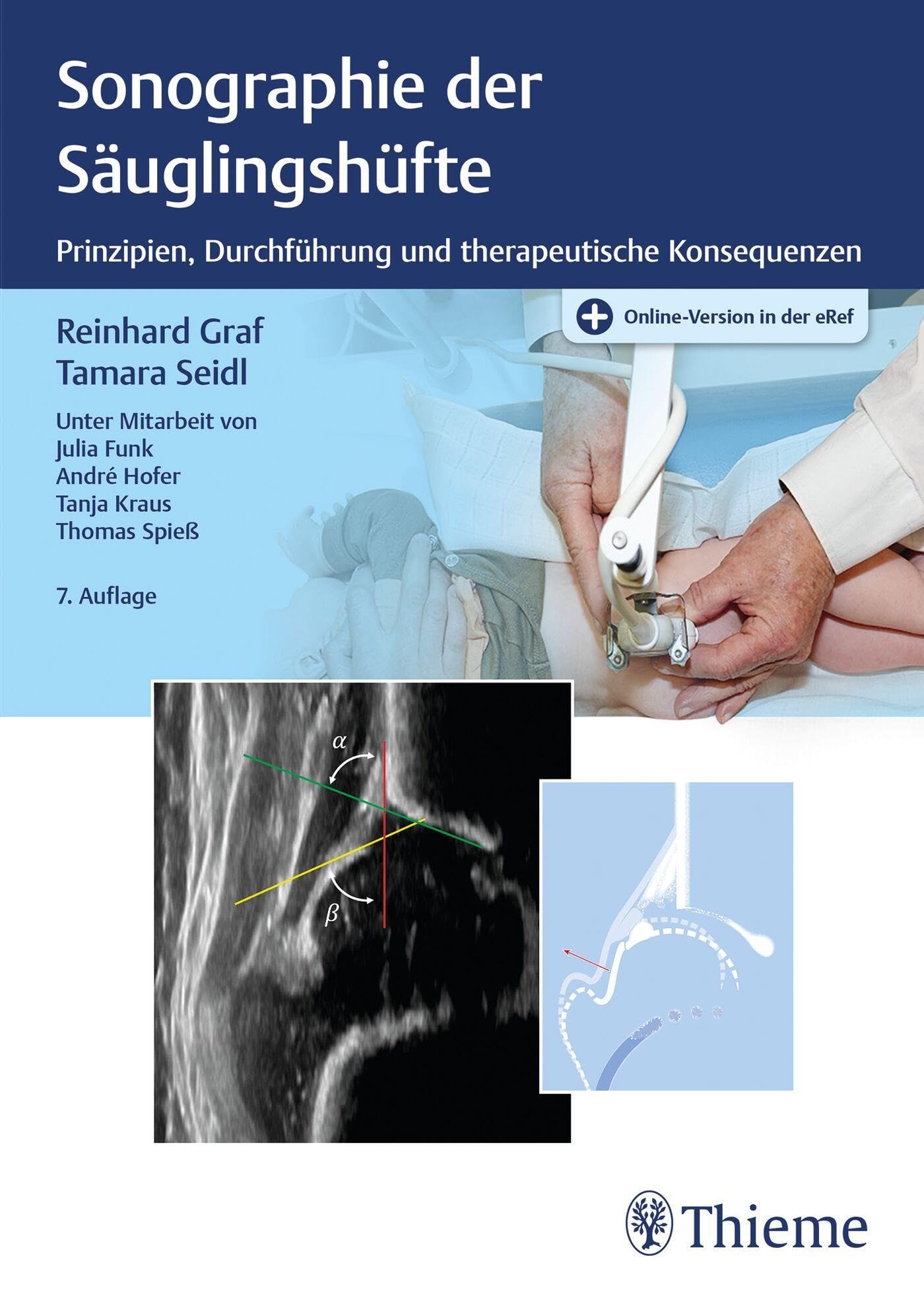 Product Image: Sonographie der Säuglingshüfte