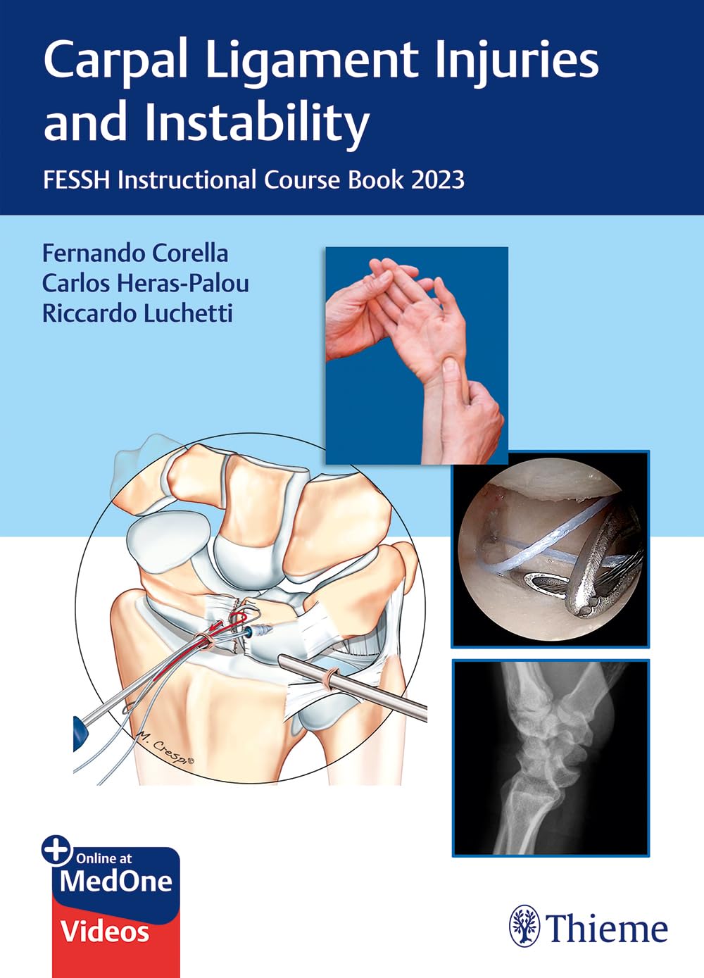 Carpal Ligament Injuries and Instability: Fessh Instructional Course Book 2023 book