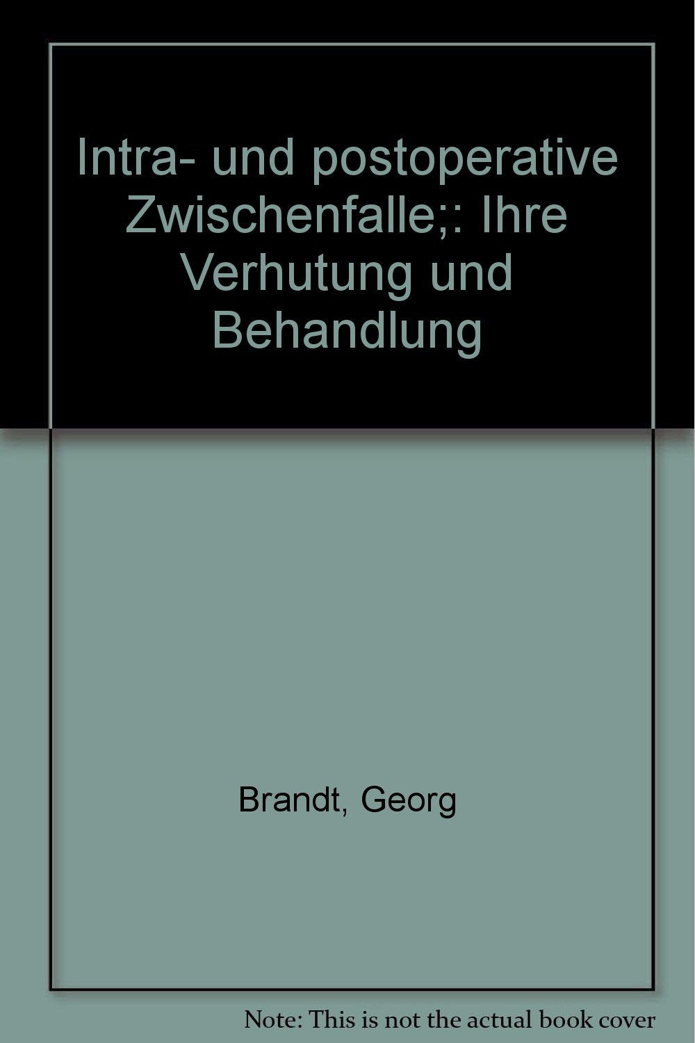 Intra- und postoperative Zwischenfalle;: Ihre Verhutung und Behandlung (German Edition) Books