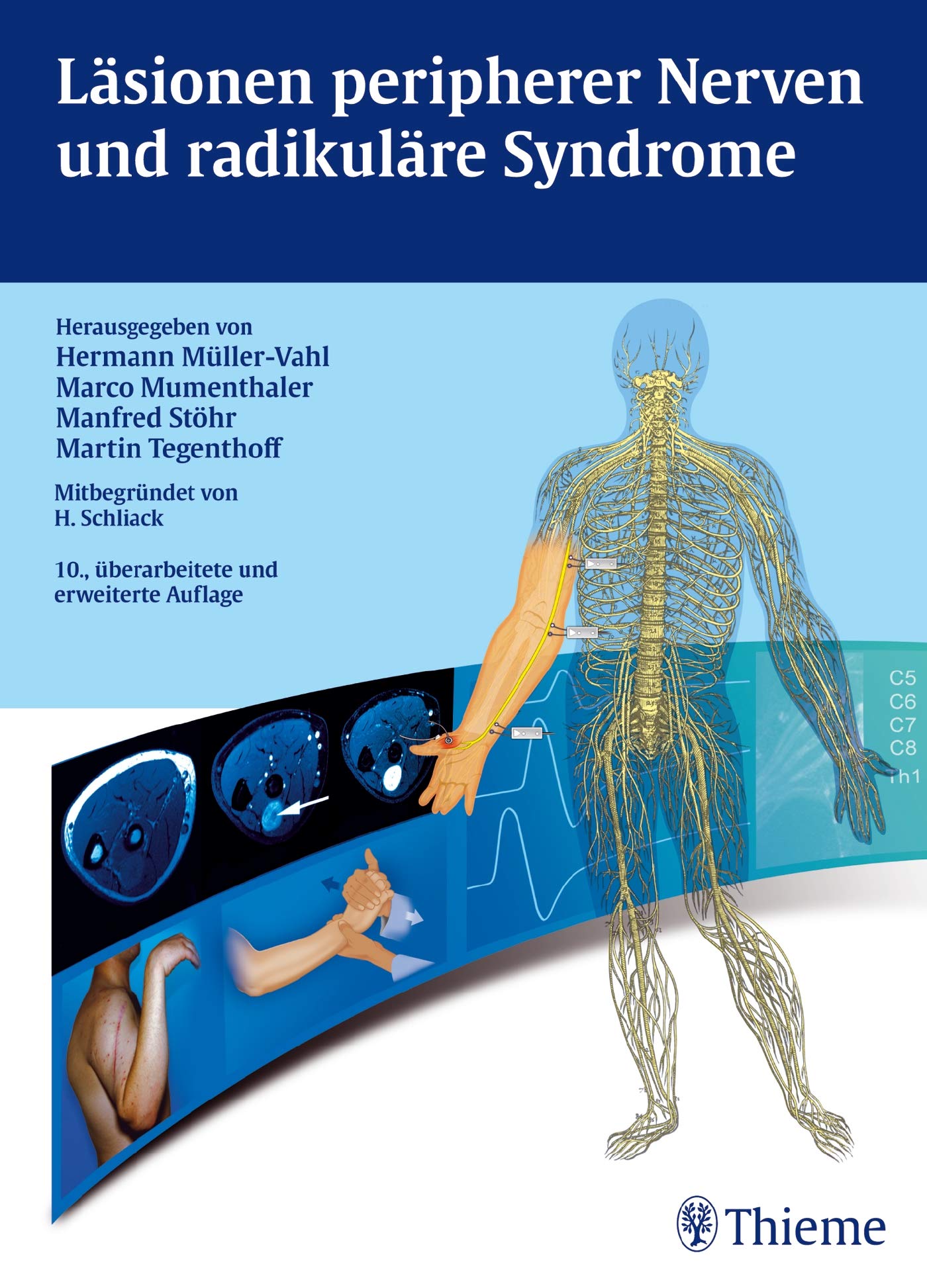 Läsionen peripherer Nerven und radikuläre Syndrome Medicine