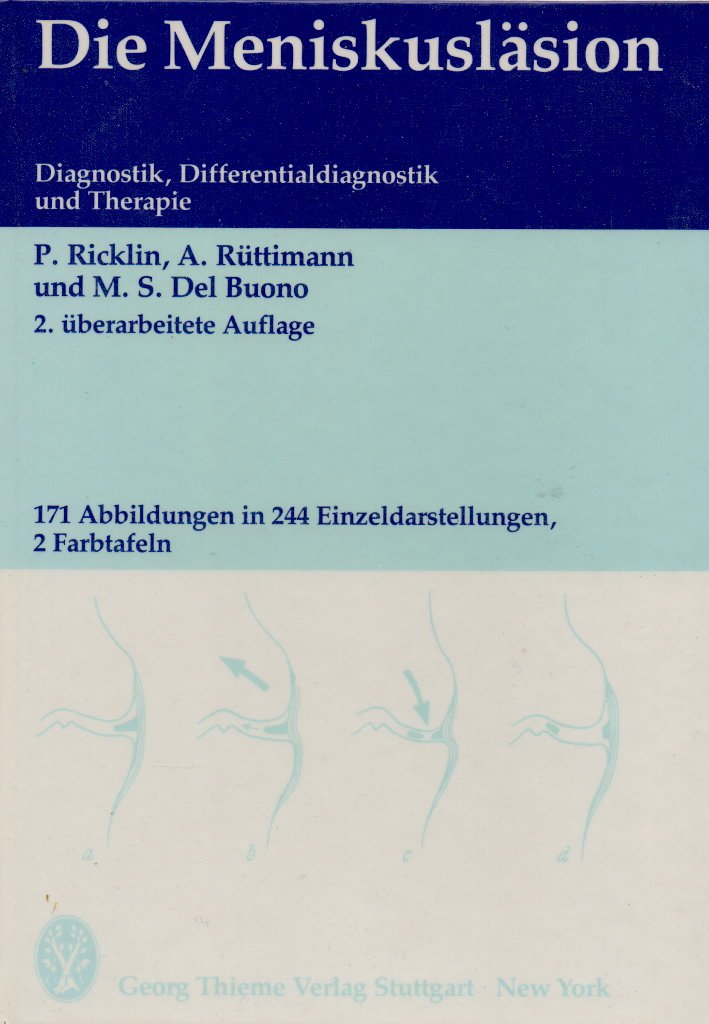 Die Meniskusläsion. Diagnostik, Differentialdiagnostik und Therapie Medicine